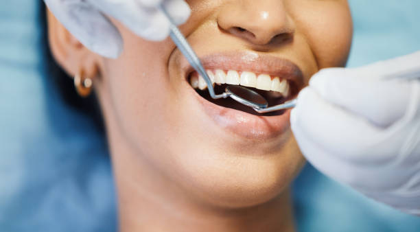 Best Emergency Dentist for Special Needs Patients in Wollochet, WA